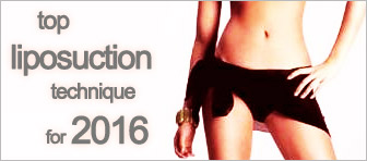 top liposuction technique for 2016